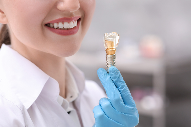 Understanding Root Canal Treatments and Why They Matter