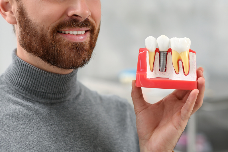 Cone Beam CT in Root Canal Planning: Benefits and Limitations