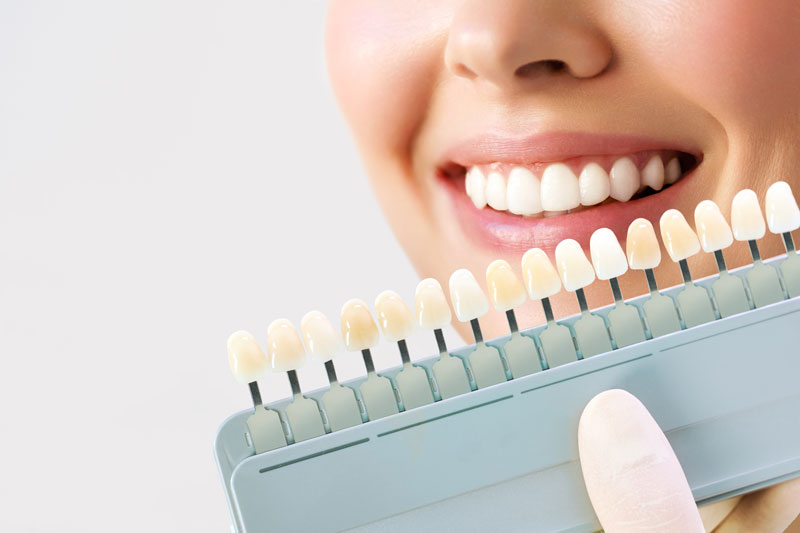 Complete Mouth Dental Implants vs. All-on-4: Which One Fits You Best?