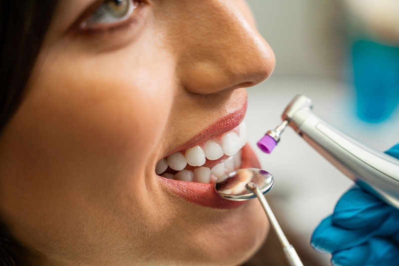 Understanding Veneers on Two Front Teeth: A Comprehensive Guide to Porcelain Veneers