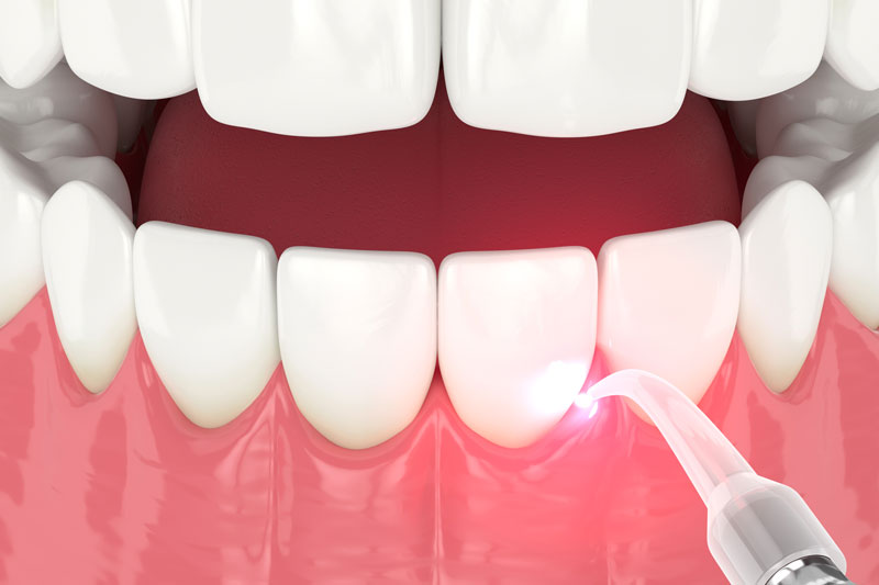 How Food Choices Impact Kids’ Teeth